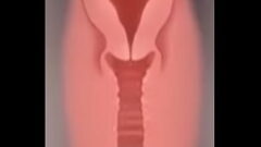 X-ray
